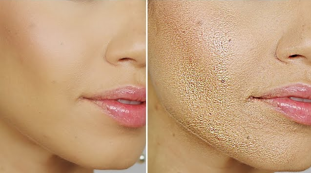 How to Fix Your Foundation and Concealer When They Start Acting Up post thumbnail image